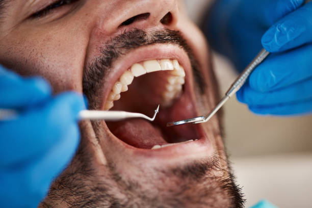 Best Emergency Gum Pain Relief  in Tecumseh, MI