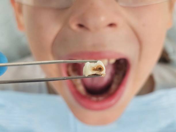 Best Emergency Pediatric Dentist  in Tecumseh, MI